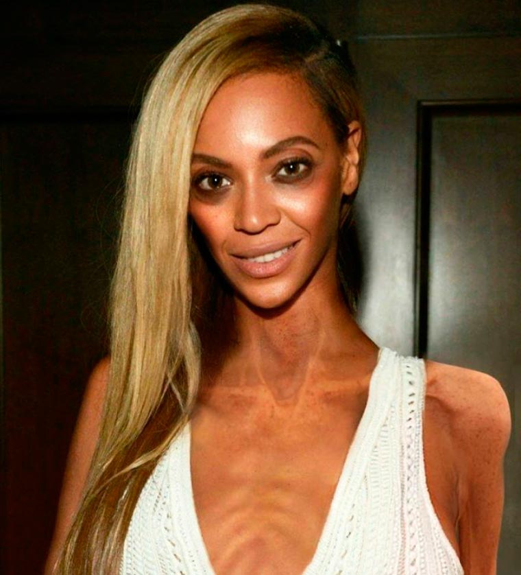 Anorexic-Celebrities-10